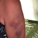Homem espanca mulher com amortecedor de moto e faz revelação chocante