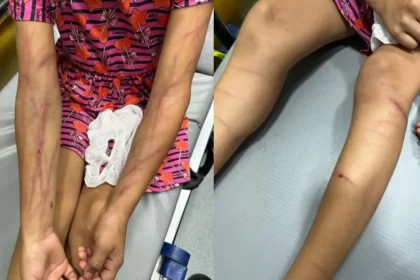 Mãe é presa por agredir filha de 9 anos com carregador de celular e pisadas no pescoço em Roraima