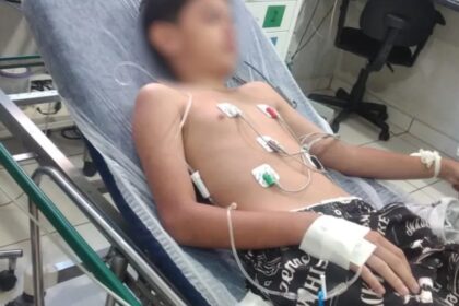 Mãe de menino que comeu lagartixa diz que criança ainda tem sequelas; saiba mais