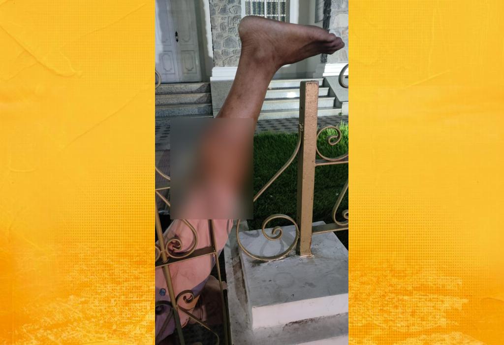 Homem fica com a perna presa ao tentar pular grade da Prefeitura de Santo Antônio de Jesus