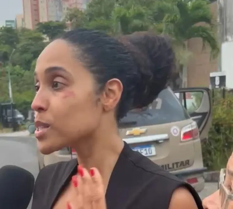 “O que importa é que estou viva”