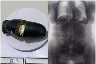 BodyScan flagra visitante com drogas escondidas nas partes íntimas em presídio da Bahia