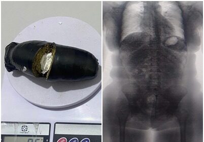BodyScan flagra visitante com drogas escondidas nas partes íntimas em presídio da Bahia