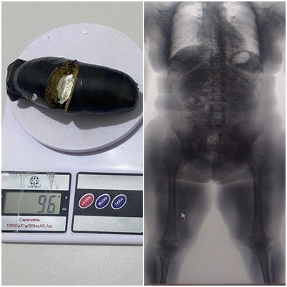 BodyScan flagra visitante com drogas escondidas nas partes íntimas em presídio da Bahia