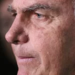 Bolsonaro passa por novo procedimento após crise de soluços