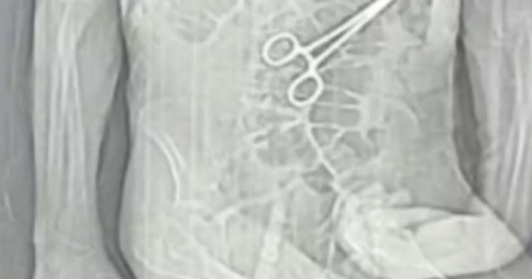 Secretaria de Saúde de João Pinheiro confirma retirada