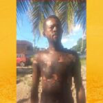 Homem sofre queimaduras após ser atingido por óleo quente durante confusão em bar na Ilha de Itaparica