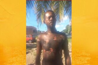 Homem sofre queimaduras após ser atingido por óleo quente durante confusão em bar na Ilha de Itaparica