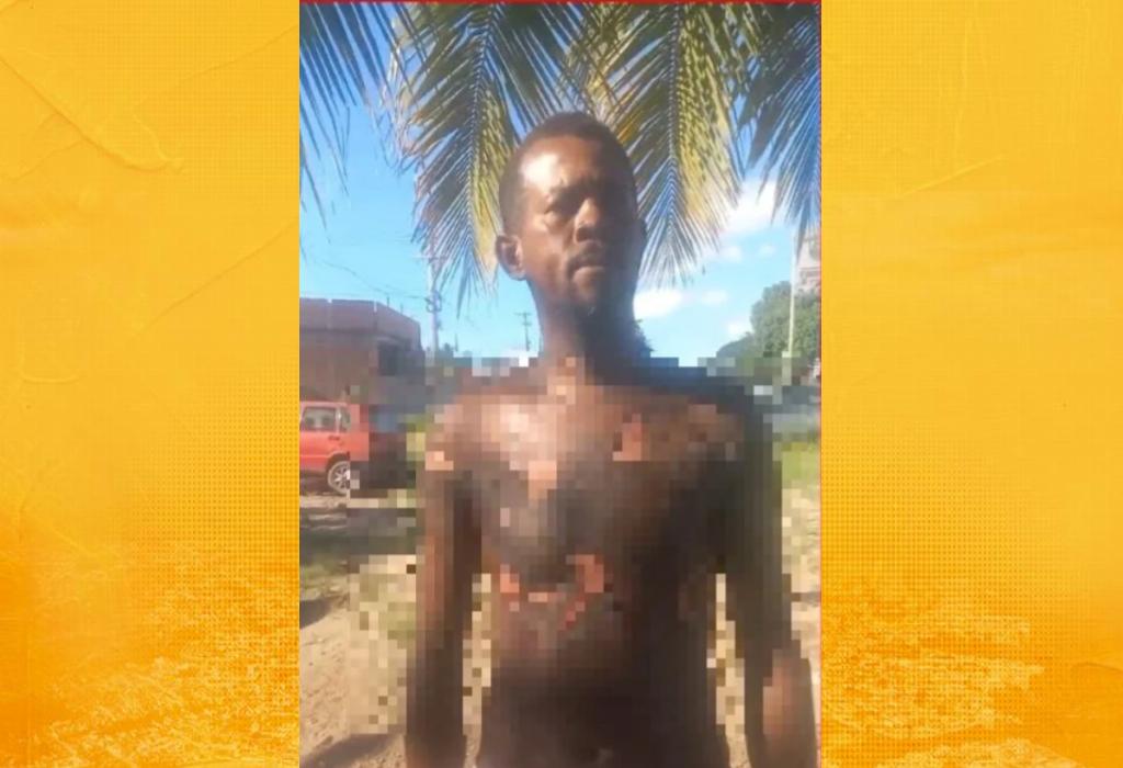 Homem sofre queimaduras após ser atingido por óleo quente durante confusão em bar na Ilha de Itaparica