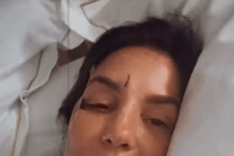 Ivete Sangalo surge com olho roxo após desmaiar e ser internada em hospital de Salvador