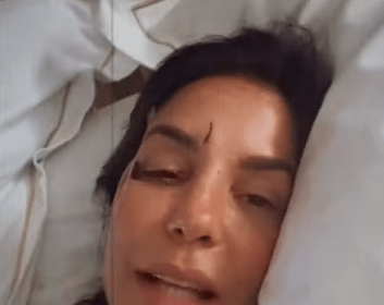 Ivete Sangalo surge com olho roxo após desmaiar e ser internada em hospital de Salvador