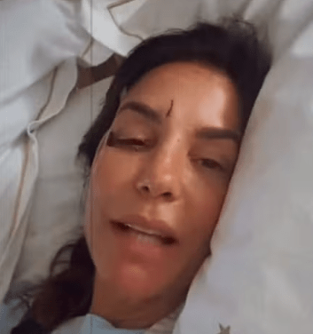 Ivete Sangalo surge com olho roxo após desmaiar e ser internada em hospital de Salvador