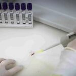 Paciente em SP com suspeita de ebola testa positivo para meningite