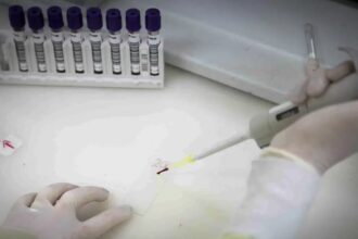 Paciente em SP com suspeita de ebola testa positivo para meningite