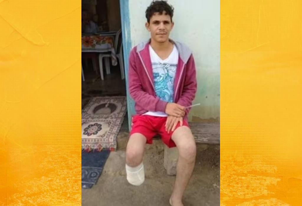 Servidor que amputou próprio pé para tentar receber R$ 1,5 milhão em seguro é encontrado com membro dentro de mochila